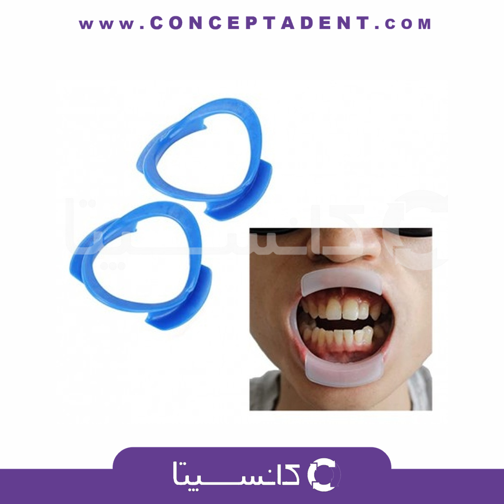 دهان بازکن کامل – سامان زر دندان