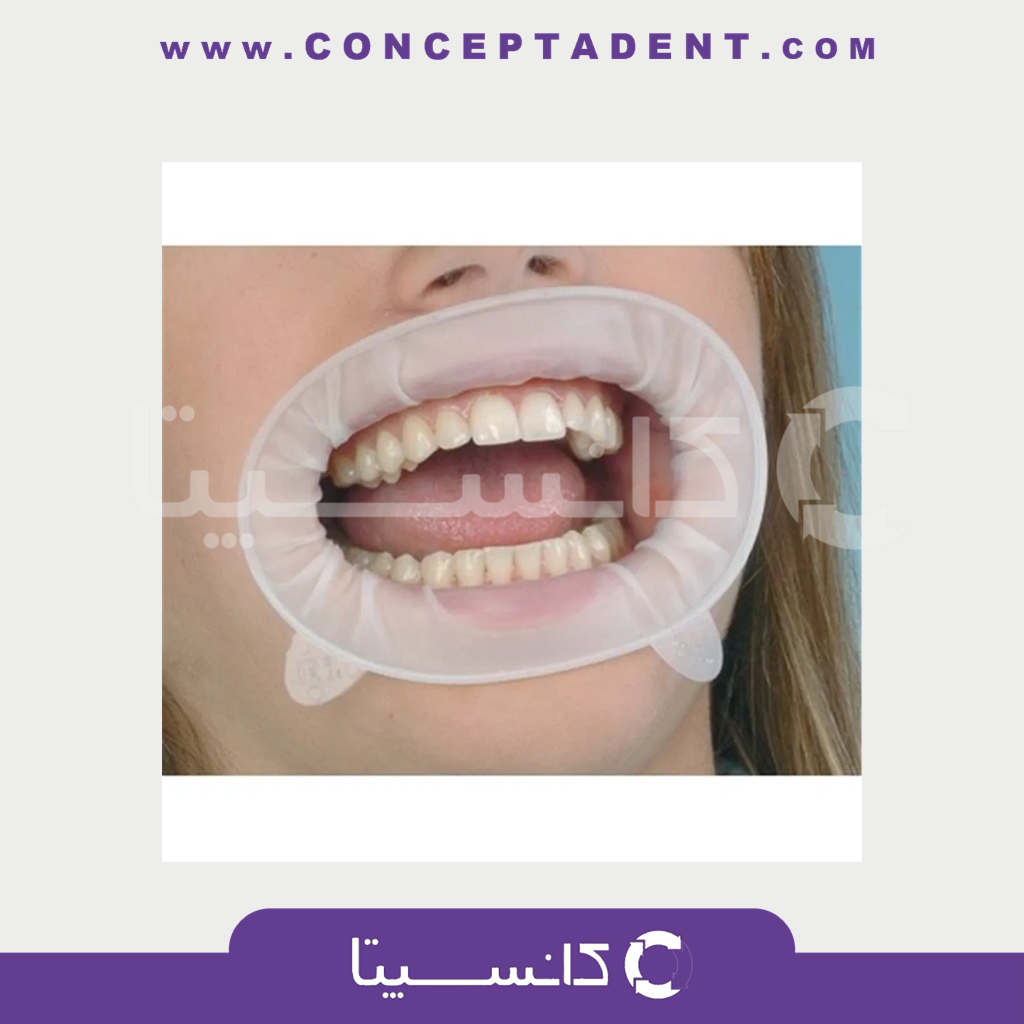 دهان بازکن اپتراگیت – OptraGate