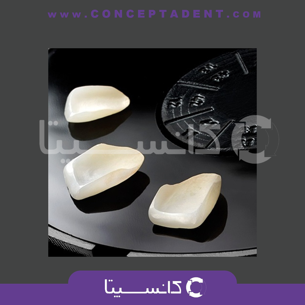 ونیر‌می اسمایل لاین – Veneer Me