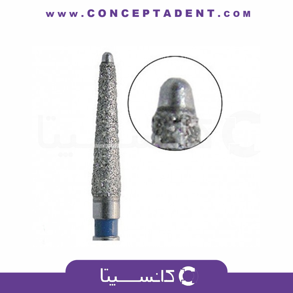 فرز روند مخصوص اندو توربین – Jota