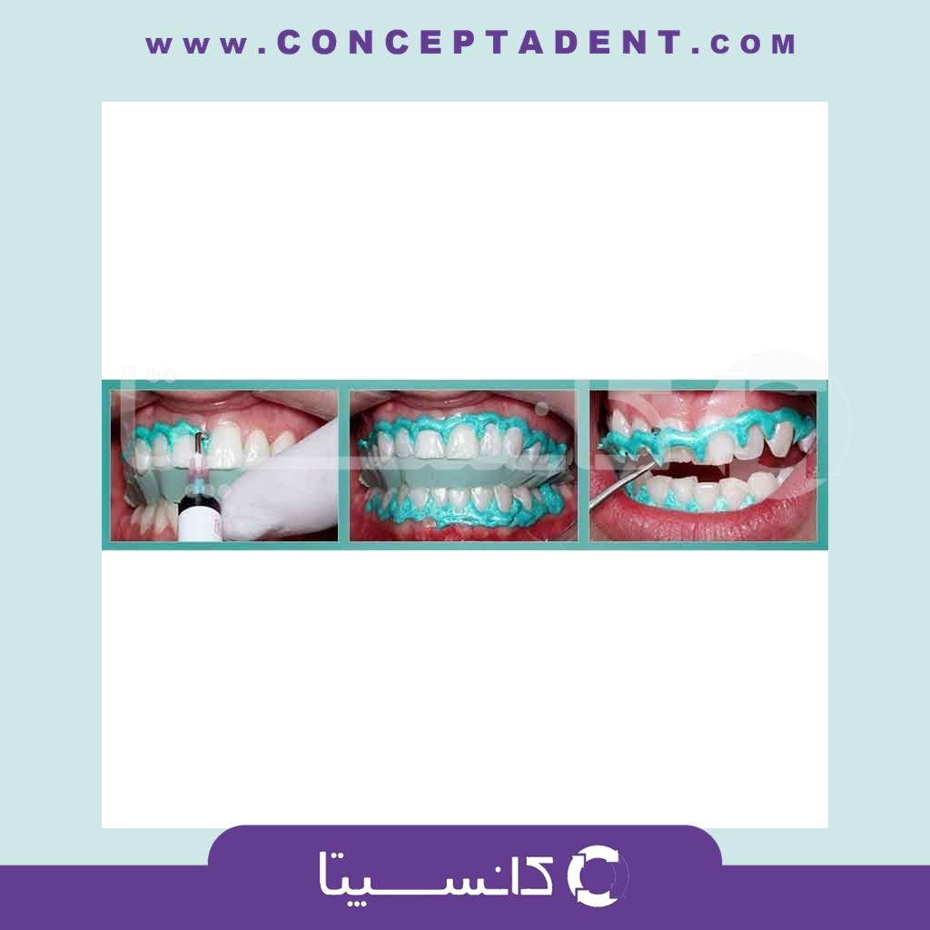 محافظ لثه لایت کیوربایودینامیکا – Biodinamica BIODAM