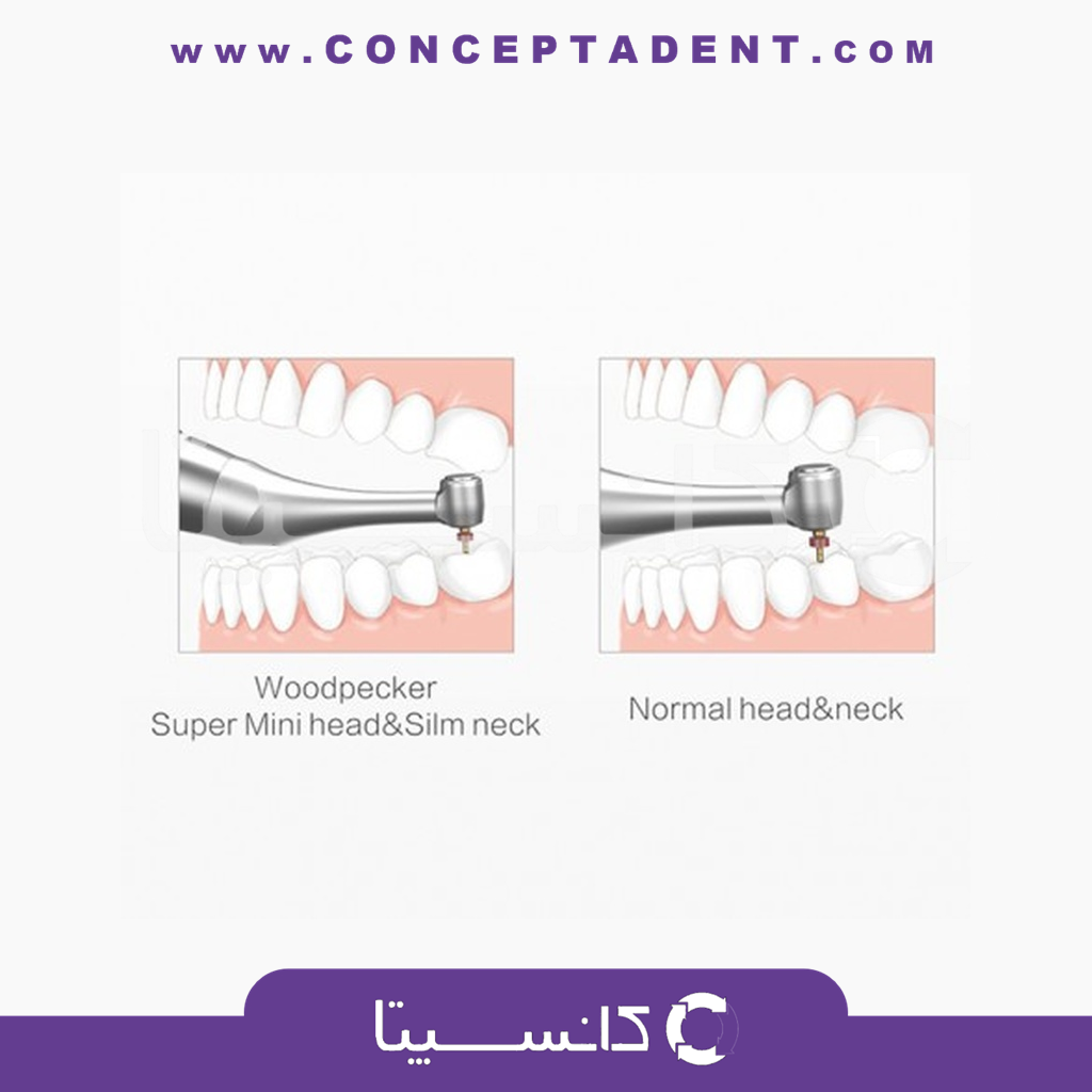 موتور اندو بی سیم DTE Woodpecker – Motopex