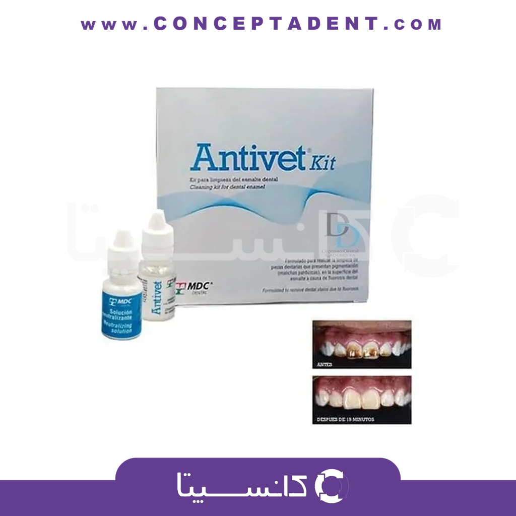 کیت پاک کننده stain دندانی – Antivet Kit MDC