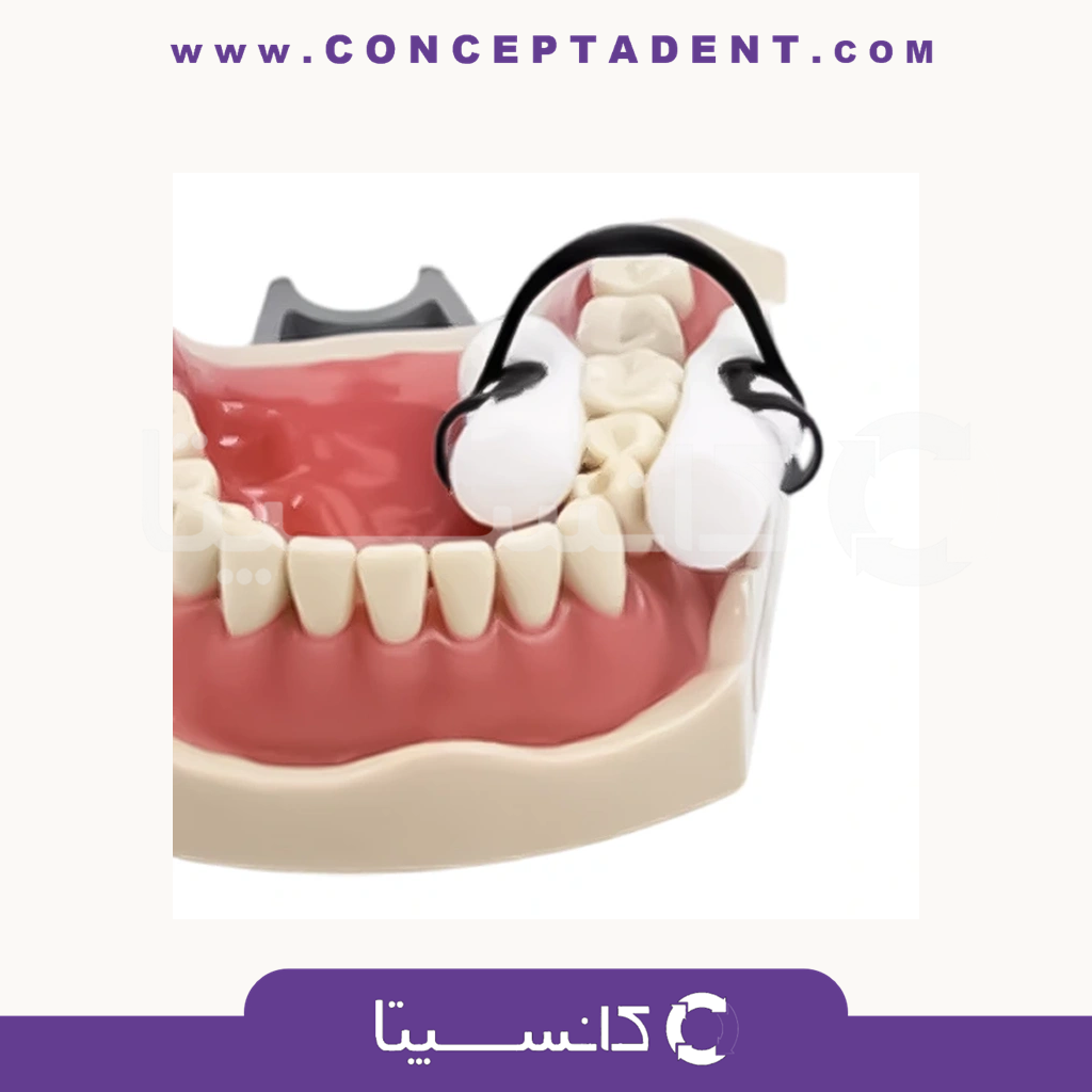 گیره نگهدارنده رول پنبه – Cotton Roll Clip