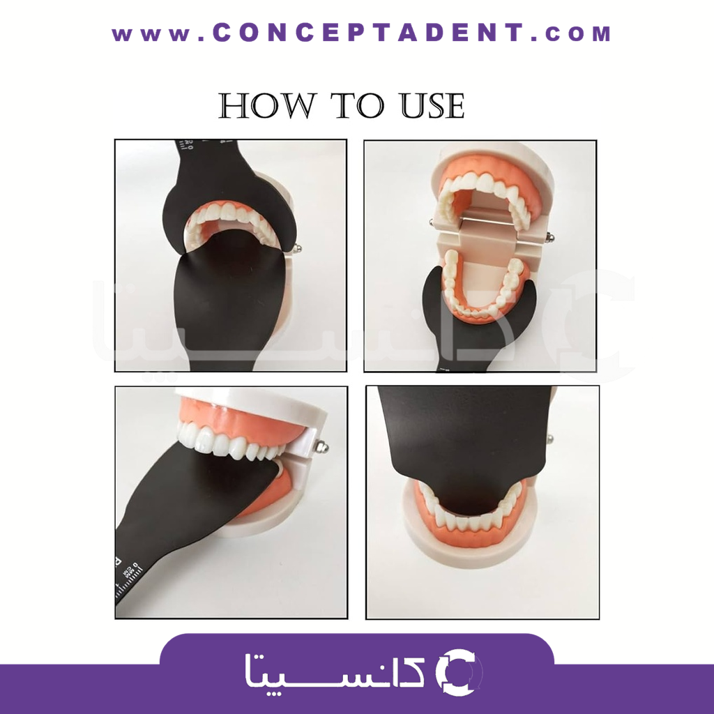 کنتراستر فوتوگرافی – Dental Photography contraster