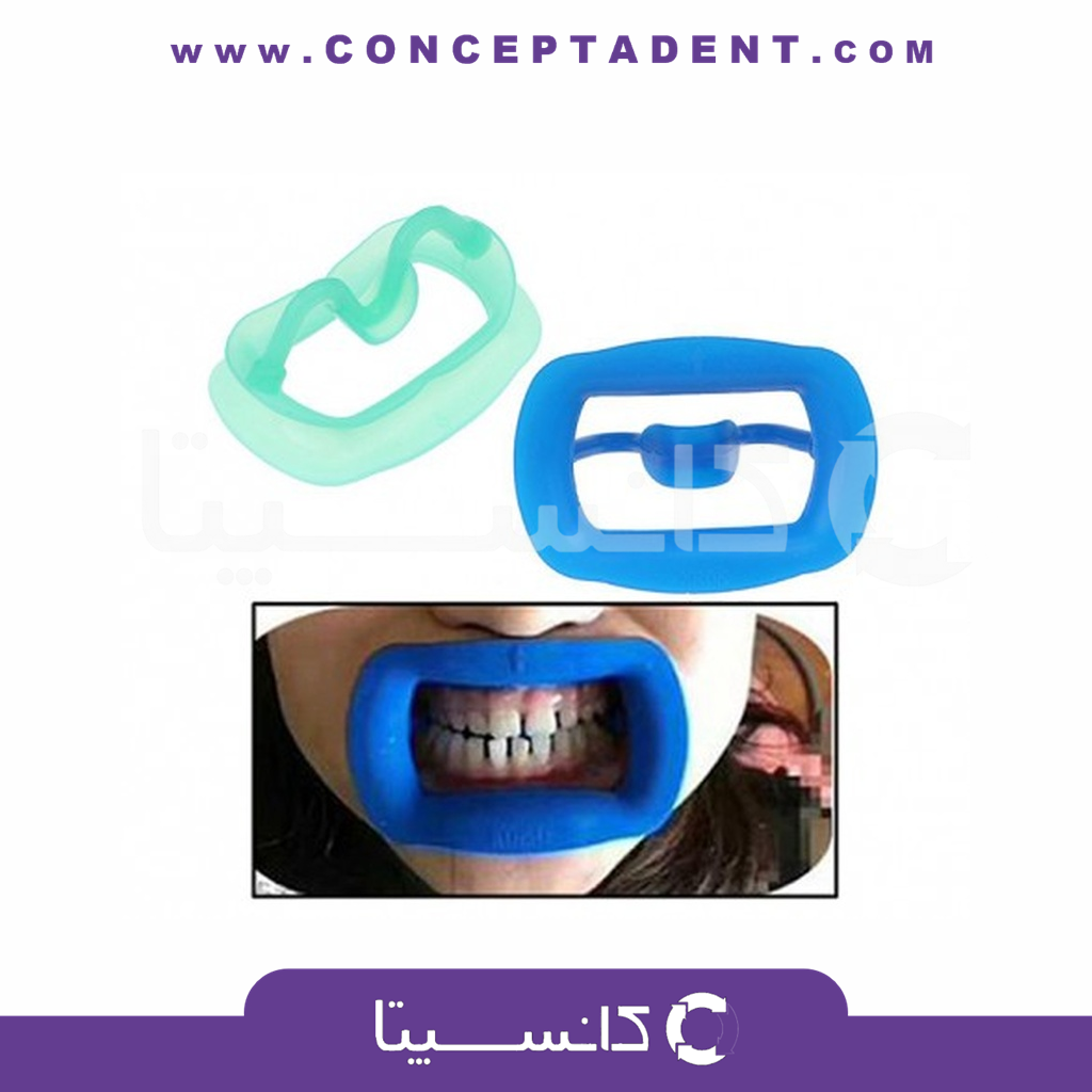 دهان بازکن کامل با زبان گیر – سامان زر دندان