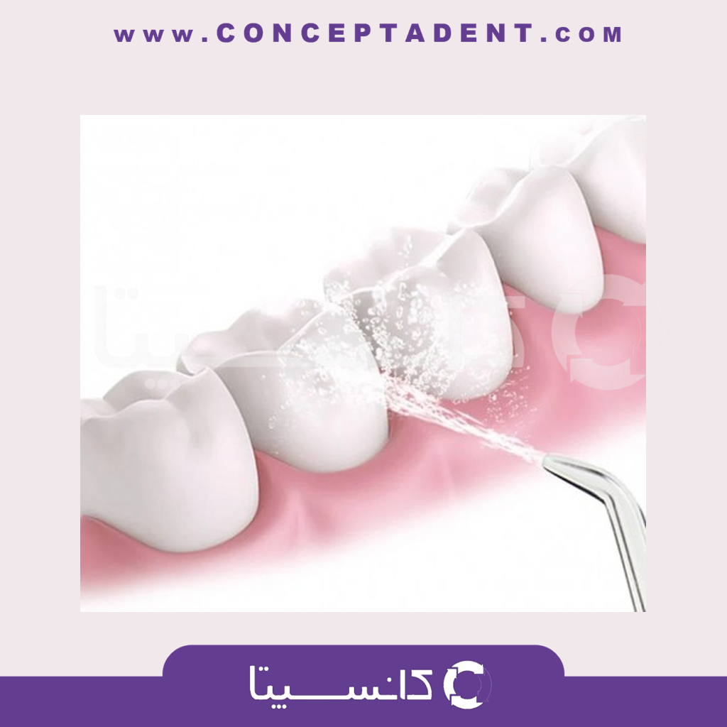 نازل مستقیم مدل Waterpulse – ST-300