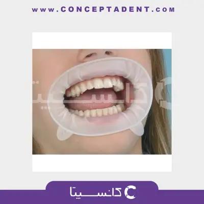 دهان بازکن اپتراگیت – OptraGate