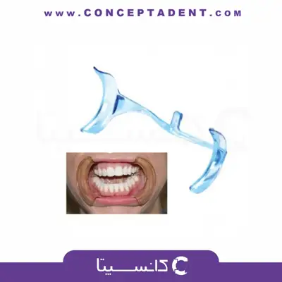 دهان بازکن داخل دهانی قابل اتوکلاو – Autoclavable Intraoral Mouth Opener