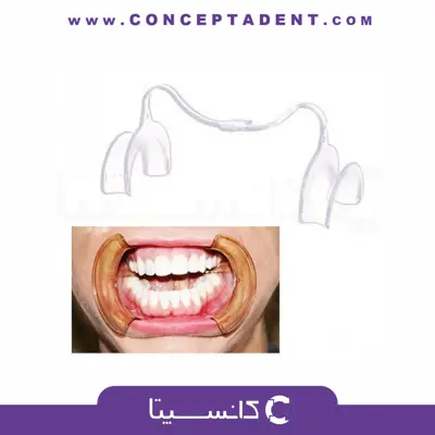دهان بازکن و زبان گیر داخل دهانی شفاف – Cotisen