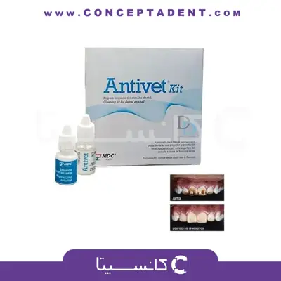 کیت پاک کننده stain دندانی – Antivet Kit MDC