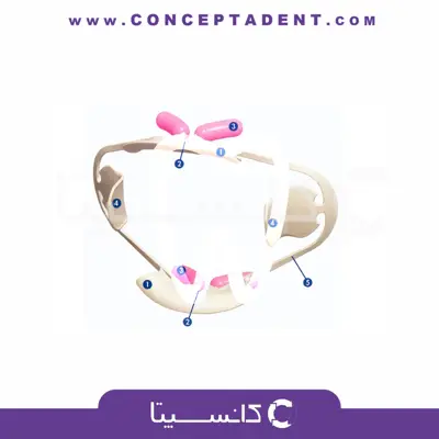 دهان بازکن اپتی ویو کر – Optiview