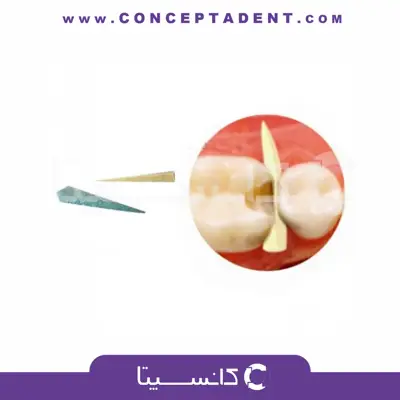 وج چوبی – پارس آوا