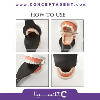 کنتراستر فوتوگرافی – Dental Photography contraster